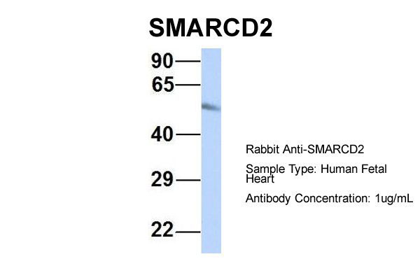 1 - SMARCD2 antibody - middle region AI10492