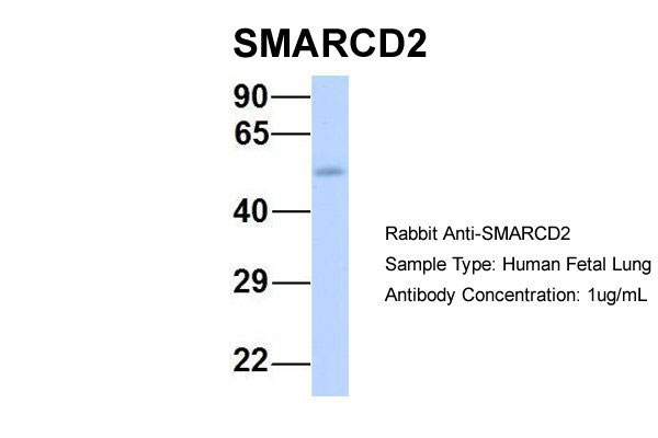 1 - SMARCD2 antibody - middle region AI10492