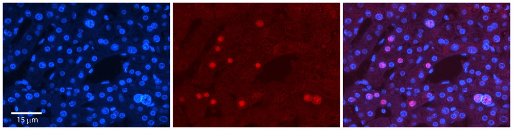 2 - ZNF3 antibody - N-terminal region AI10523