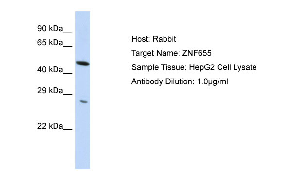 1 - ZNF655 Antibody - N-terminal region AI10531