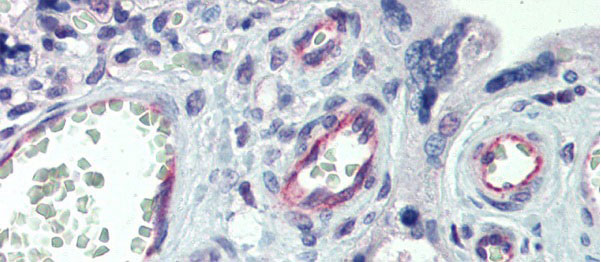 2 - CLDN23 antibody - C-terminal region AI10540