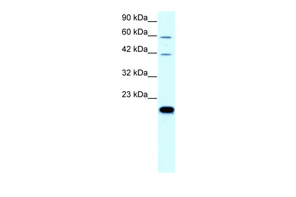 1 - CLDN23 antibody - C-terminal region AI10540