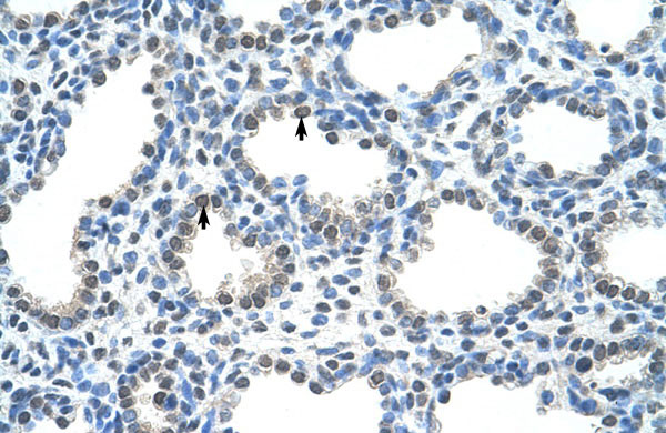 2 - PIR antibody - C-terminal region AI10545