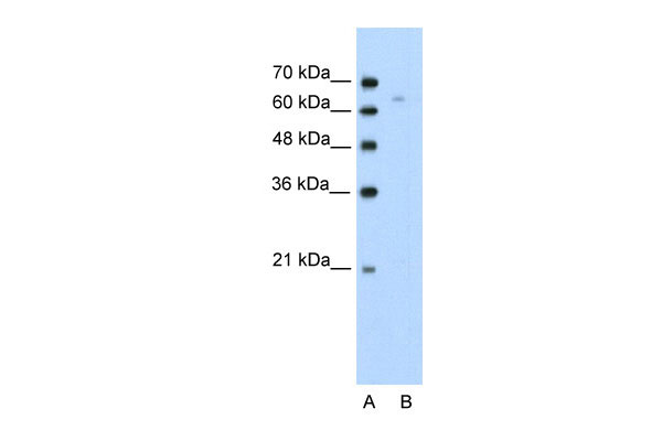 1 - TOX antibody - N-terminal region AI10549