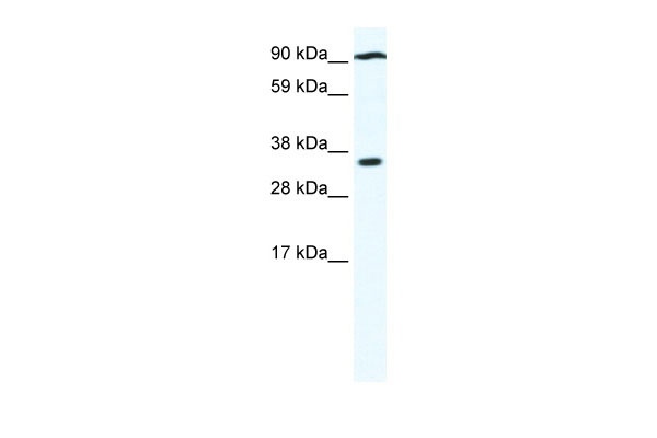 1 - PARP16 antibody - N-terminal region AI10556