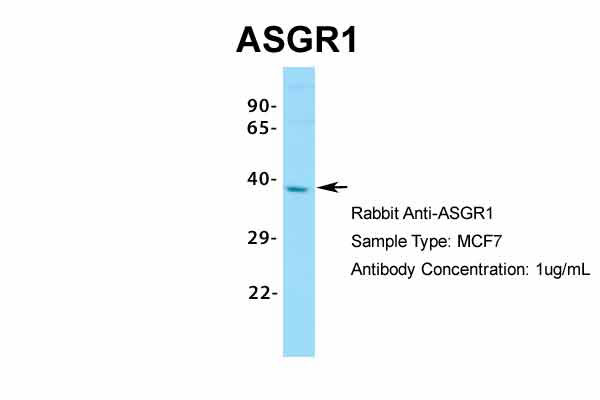1 - ASGR1 antibody - N-terminal region AI10564