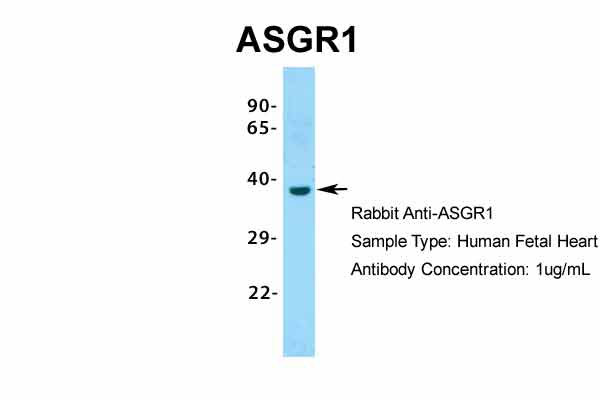 1 - ASGR1 antibody - N-terminal region AI10564