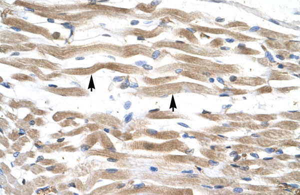 2 - KIFC2 antibody - N-terminal region AI10585
