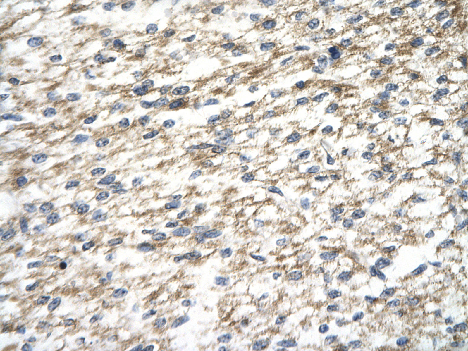 2 - PARP12 antibody - middle region AI10592