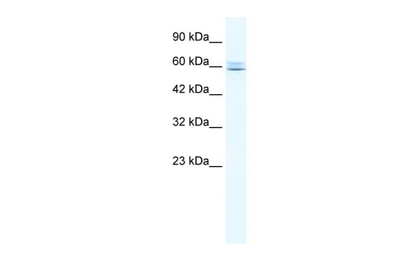 1 - CBFA2T3 antibody - N-terminal region AI10594