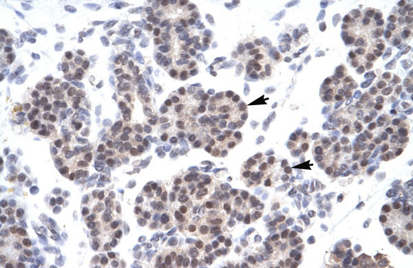 2 - XRCC5 antibody - C-terminal region AI10608