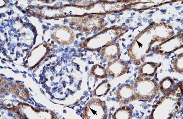 2 - FHL1 antibody - C-terminal region AI10641