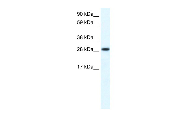 1 - FHL1 antibody - C-terminal region AI10641