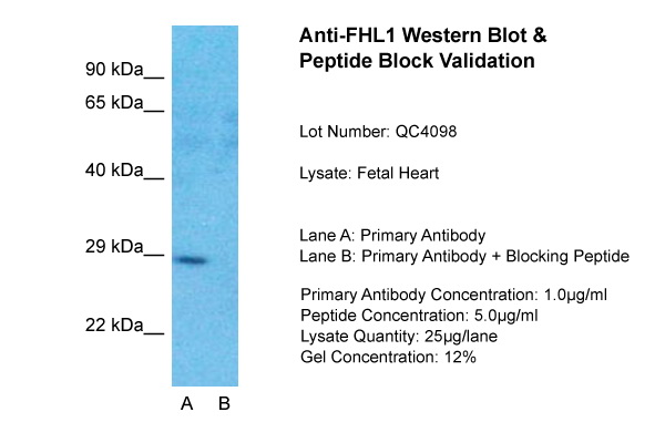 1 - FHL1 antibody - C-terminal region AI10641