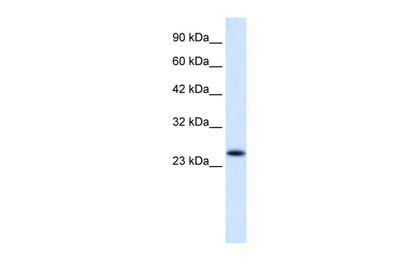 1 - VPS24 antibody - N-terminal region AI10647