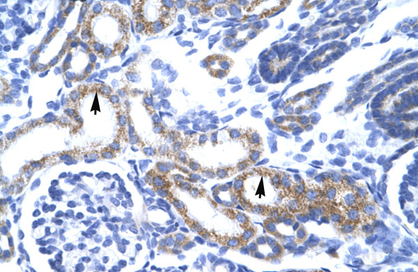 2 - ZA20D3 antibody - middle region AI10648