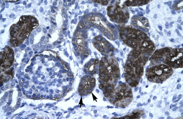 2 - DKFZP761C169 antibody - N-terminal region AI10655