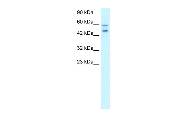 1 - DKFZP761C169 antibody - N-terminal region AI10655