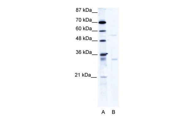 1 - TRIM17 antibody - C-terminal region AI10685