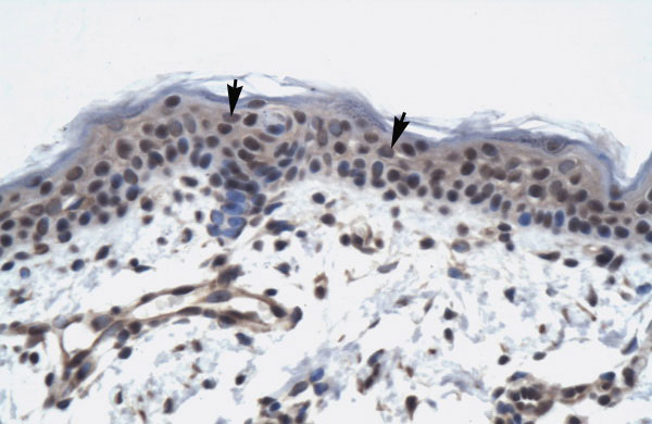 2 - TAF9 antibody - N-terminal region AI10686