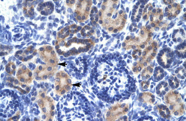 2 - RNF141 antibody - middle region AI10687