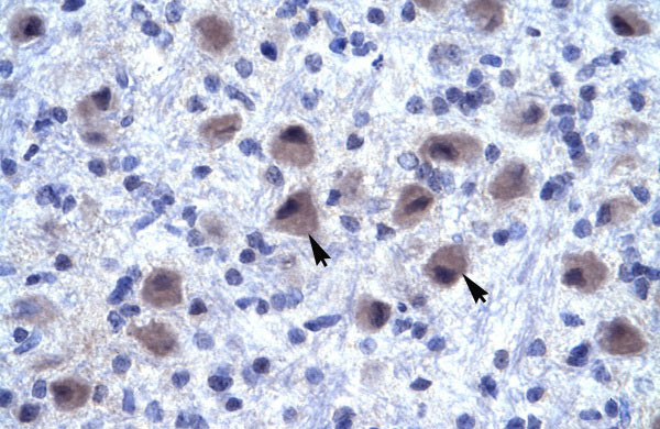 2 - RNF141 antibody - middle region AI10687