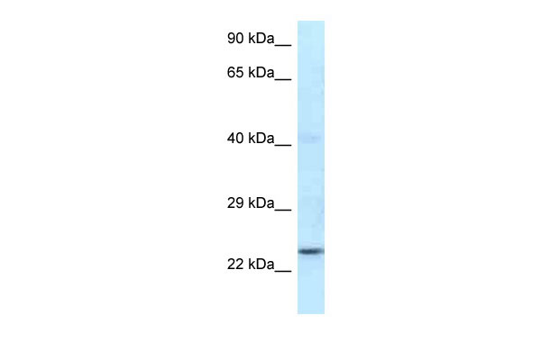 1 - Rnf141 antibody - N-terminal region AI10688