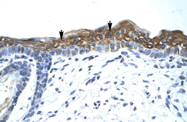 2 - SUV420H1 antibody - C-terminal region AI10690