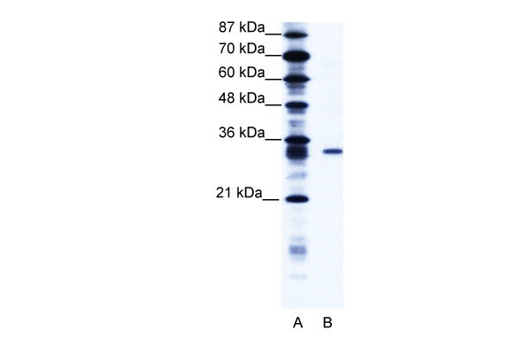 1 - KCNIP4 antibody - N-terminal region AI10698
