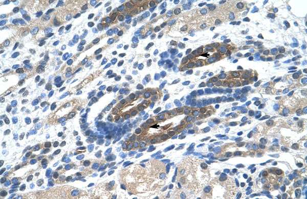 2 - BTBD14A antibody - N-terminal region AI10700
