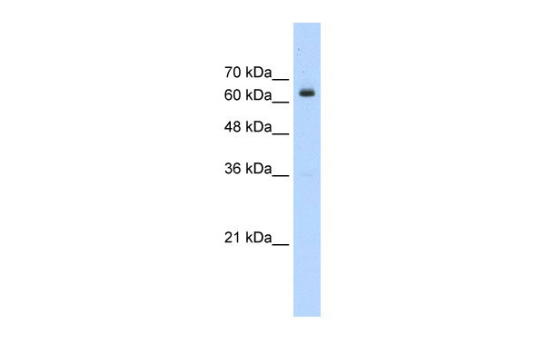 1 - BTBD14A antibody - N-terminal region AI10700