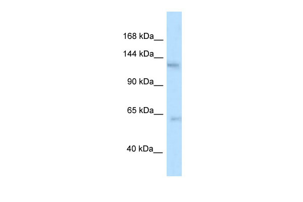 1 - Ttbk2 antibody - N-terminal region AI10704