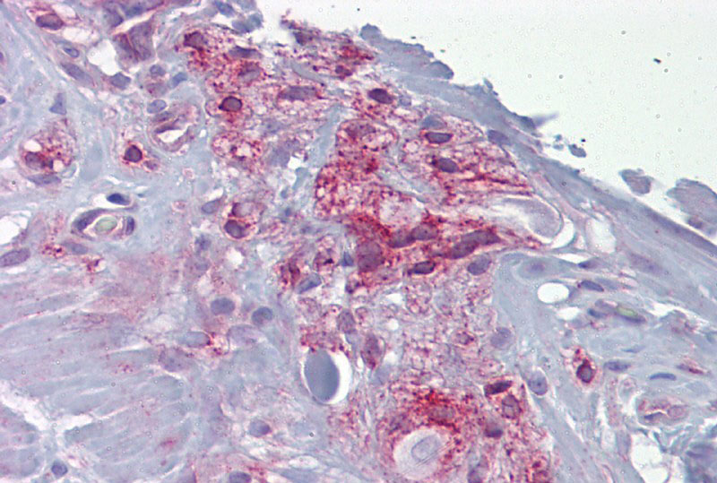 2 - ASPH antibody - middle region AI10707