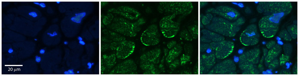 2 - ASPH antibody - middle region AI10707