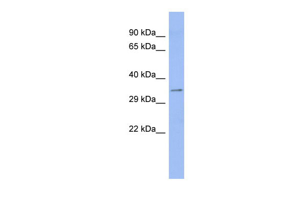 1 - ASPH antibody - middle region AI10707