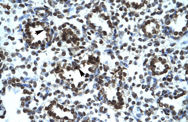 2 - PRR7 antibody - middle region AI10713