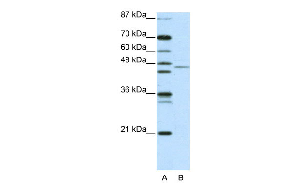 1 - TRIM14 antibody - N-terminal region AI10720