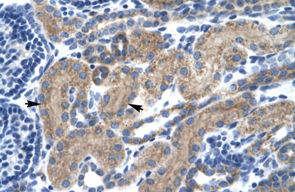 2 - TCF7 antibody - middle region AI10731