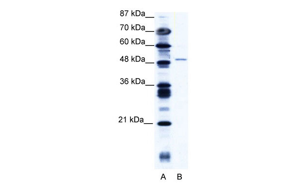 1 - ZNF627 antibody - N-terminal region AI10736