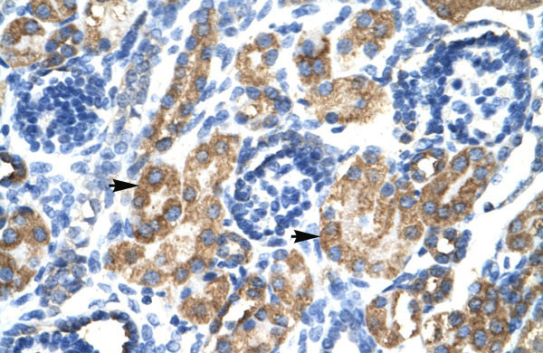 2 - HSF2BP antibody - N-terminal region AI10741