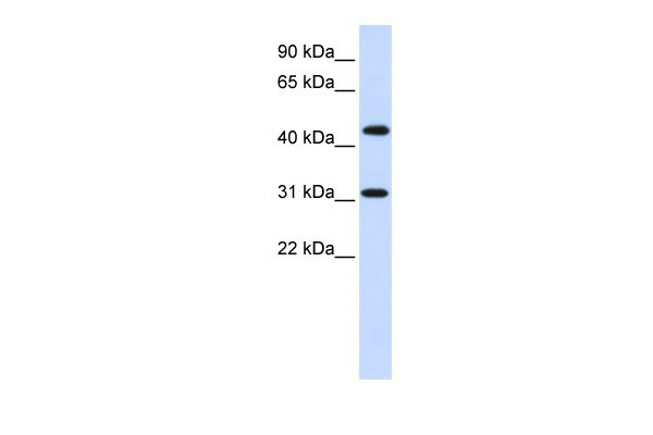 1 - ZNF684 antibody - N-terminal region AI10747