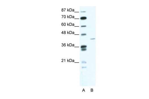 1 - ZNF568 antibody - N-terminal region AI10748