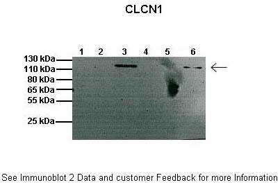 1 - Clcn1 antibody - C-terminal region AI10758