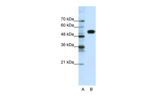 1 - CLCNKB antibody - N-terminal region AI10760