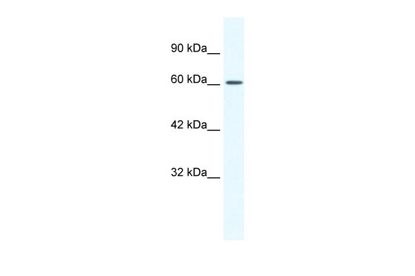 1 - CACNB2 antibody - middle region AI10764