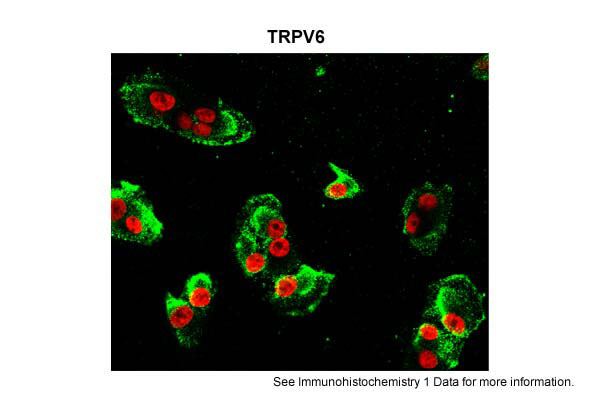 2 - Trpv6 antibody - middle region AI10813