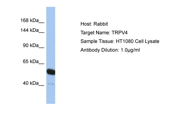 1 - TRPV4 Antibody - N-terminal region AI10820