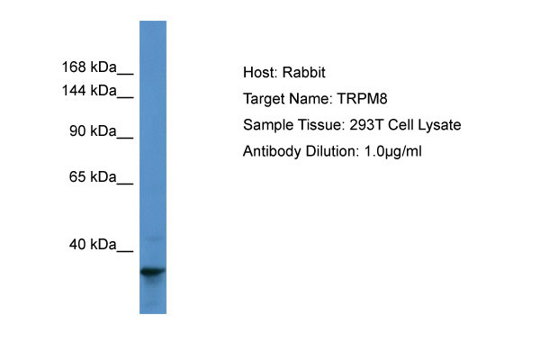 1 - TRPM8 Antibody - N-terminal region AI10824