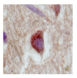 2 - SLC18A1 antibody - middle region AI10862