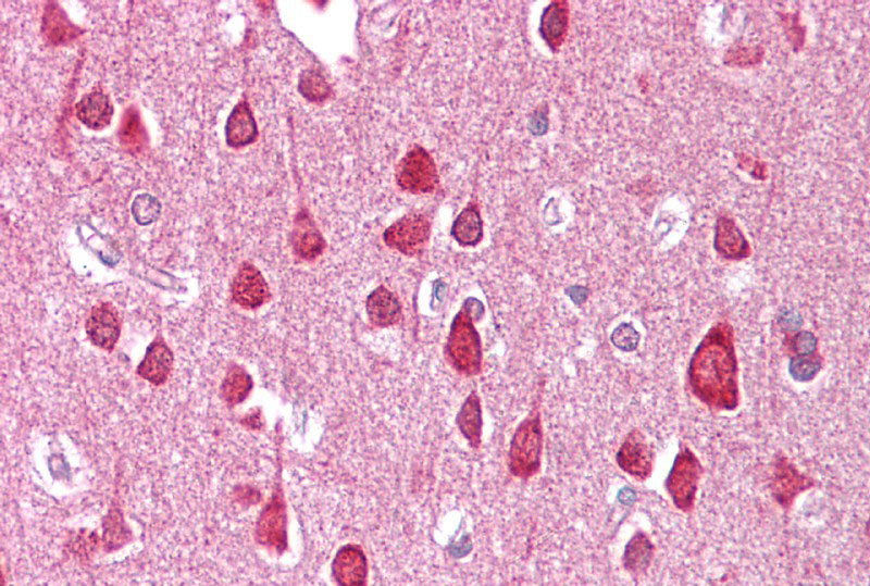 2 - SLC18A1 antibody - middle region AI10862